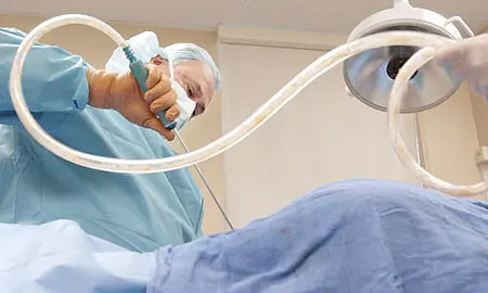 Liposuction in Dubai
