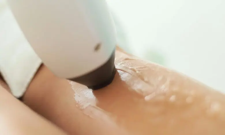 Laser Hair Removal